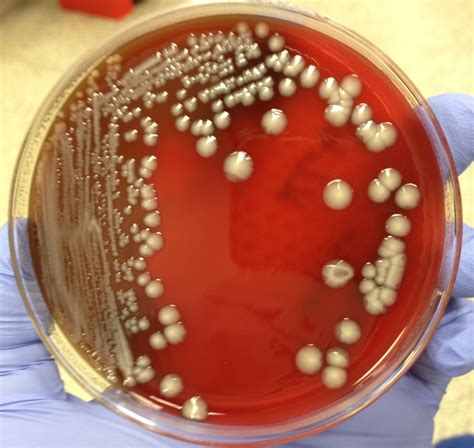 streptococcus pneumoniae on blood agar